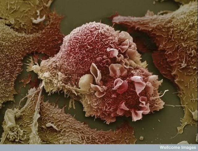 Nosso corpo através dos olhos do microscópio; veja as fotos