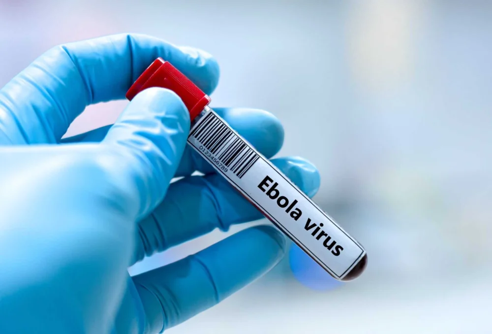 Ebola: nova vacina pode ficar pronta para testes em alguns meses