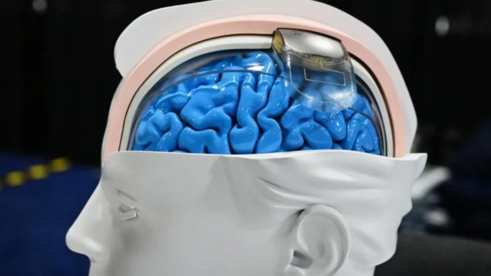 Neuralink prepara uma mudança que pode transformar o futuro das interfaces cerebrais
