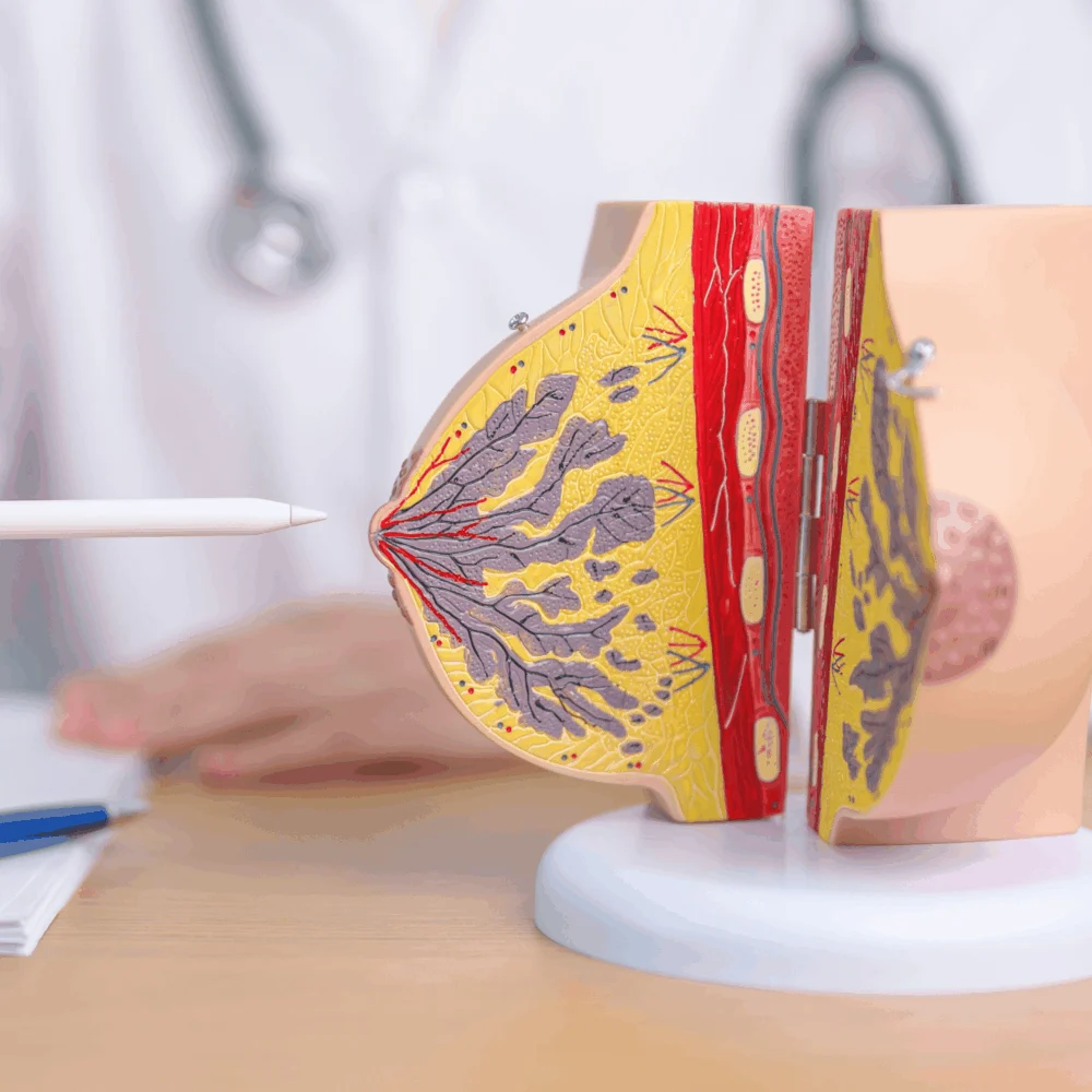 Teste genético pode evitar quimioterapia para pacientes com câncer de mama, diz estudo