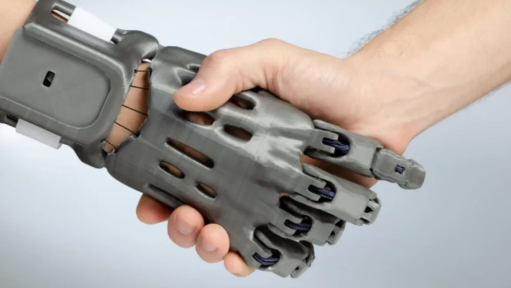 Um novo implante aproxima como nunca o cérebro humano das mãos robóticas