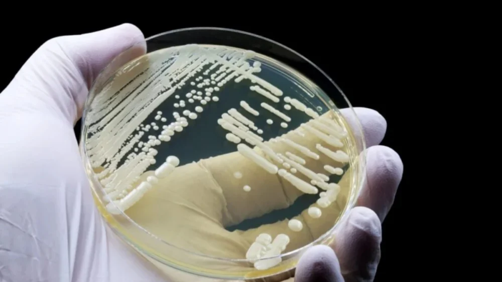Fungo mortal resistente a medicamentos pode se esconder na pele — e cientistas descobriram como