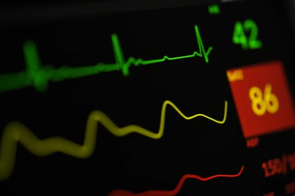 AVC: por que a perda estimada de 1,9 milhão de neurônios por minuto exige atendimento imediato
