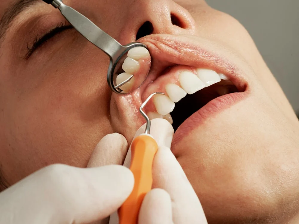 Implantes dentários podem confundir o sistema imunológico e provocar infecções difíceis de tratar, revela estudo