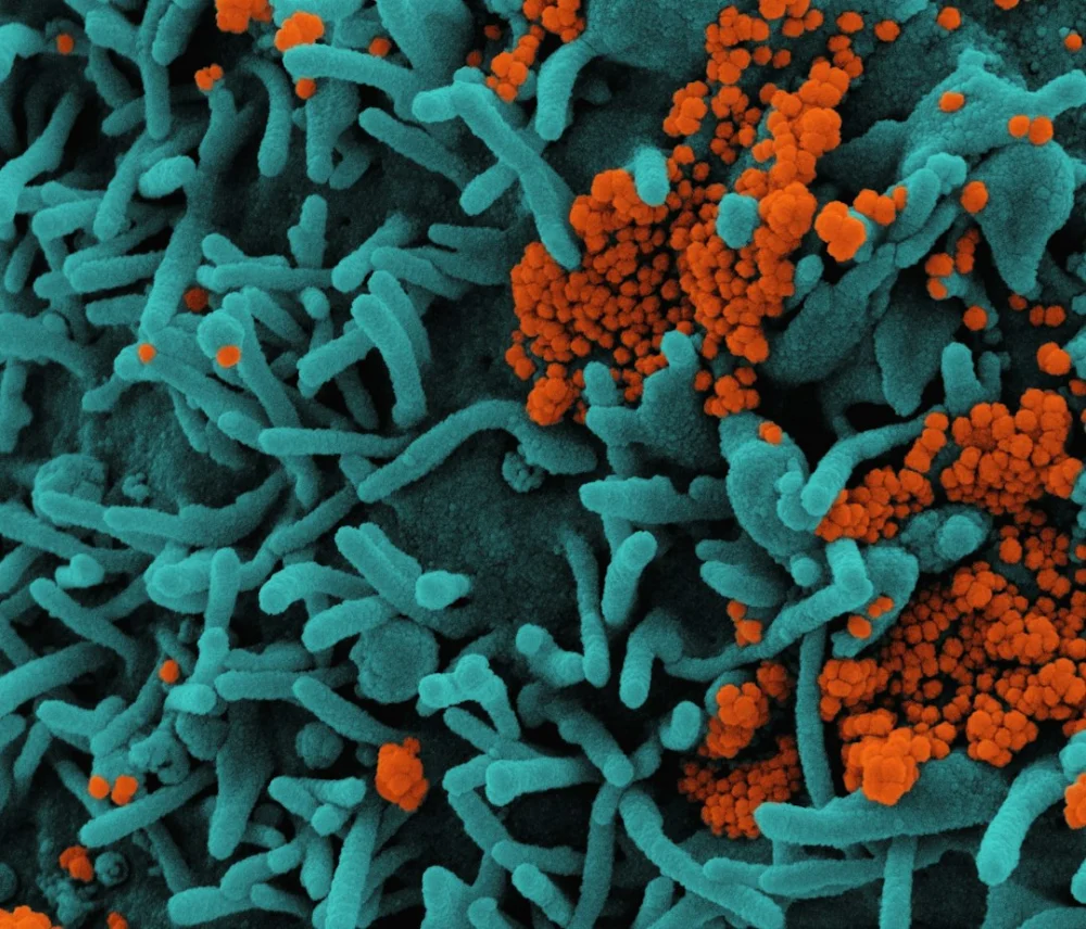 O que uma bactéria do nosso intestino faz com os anticorpos pode transformar futuras pesquisas médicas